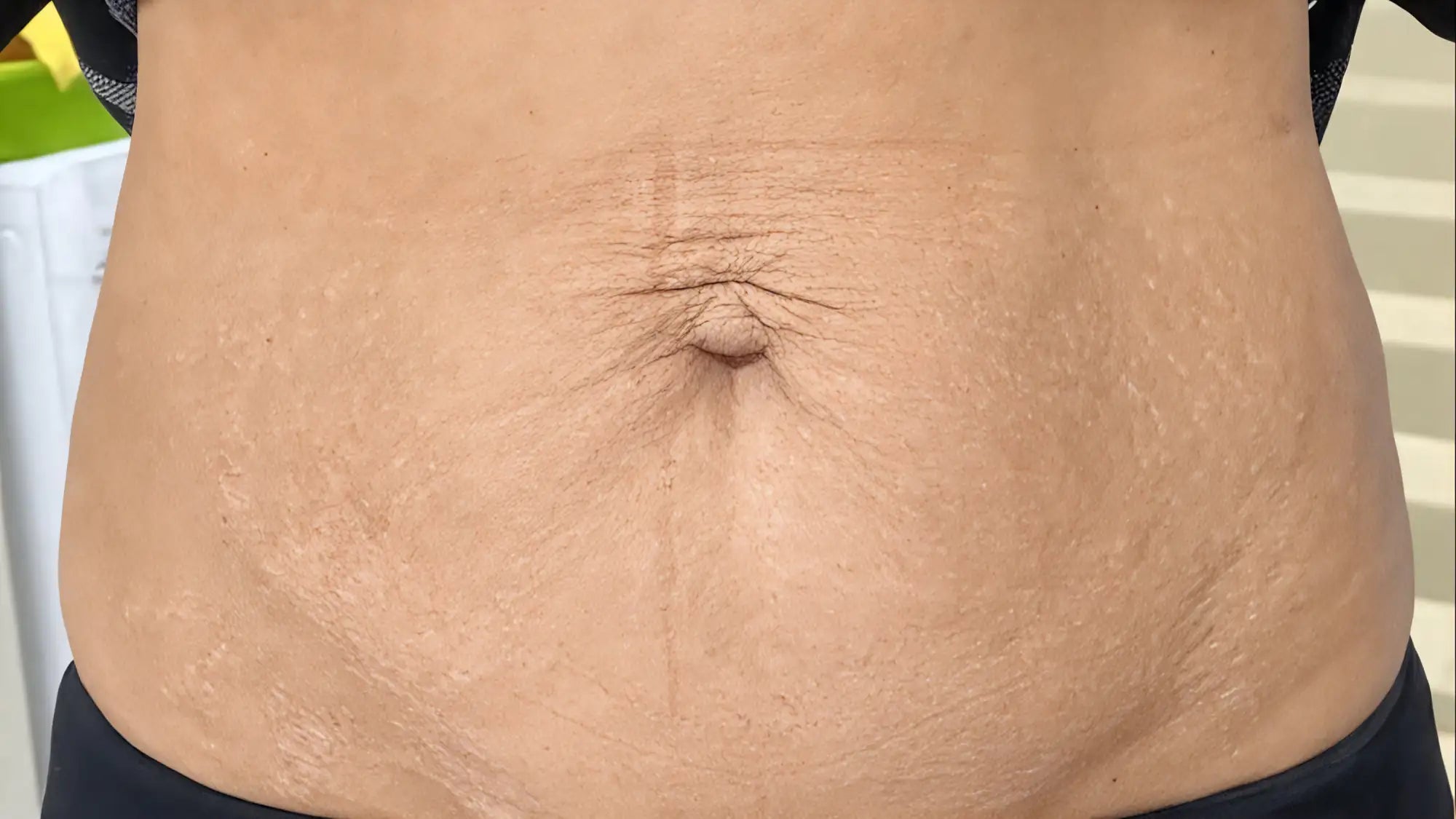 A person’s midsection with visible skin texture and a defined navel.
